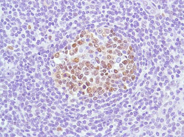 Immunohistochemistry (Formalin/PFA-fixed paraffin-embedded sections) - Anti-Bcl6 antibody [SP155] - C-terminal (AB183308)