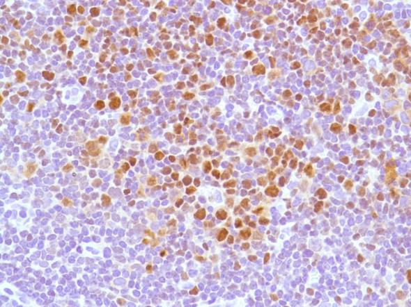 Immunohistochemistry (Formalin/PFA-fixed paraffin-embedded sections) - Anti-Bcl6 antibody [SP155] - C-terminal (AB183308)
