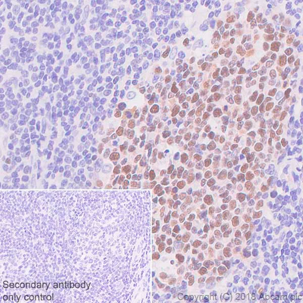 Immunohistochemistry (Formalin/PFA-fixed paraffin-embedded sections) - Anti-Bcl6 antibody [SP155] - C-terminal (AB183308)