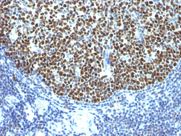 Immunohistochemistry (Formalin/PFA-fixed paraffin-embedded sections) - Anti-Bcl6 antibody [SPM602] (AB270713)