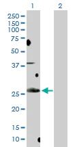 Western blot - Anti-BCL7B antibody (AB172358)