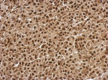Immunohistochemistry (Formalin/PFA-fixed paraffin-embedded sections) - Anti-BCL7C antibody (AB126944)