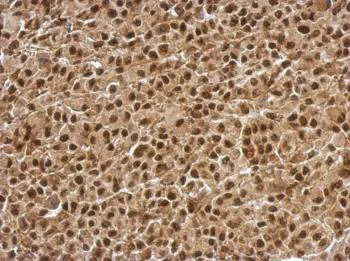 Immunohistochemistry (Formalin/PFA-fixed paraffin-embedded sections) - Anti-BCL7C antibody (AB126944)