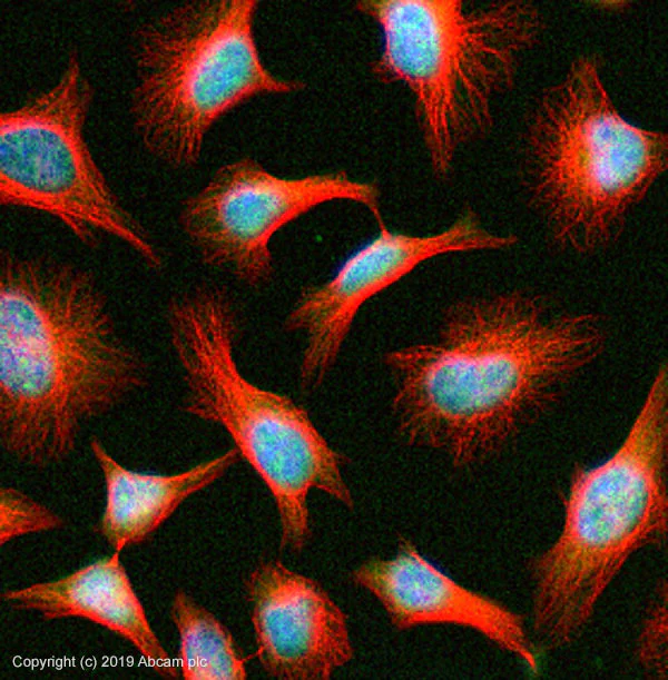 Immunocytochemistry/ Immunofluorescence - Anti-BCL9 antibody (AB37305)