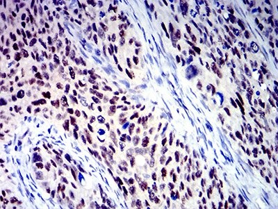 Immunohistochemistry (Formalin/PFA-fixed paraffin-embedded sections) - Anti-BCL9L antibody [3B9C1] (AB233736)