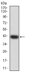 Western blot - Anti-BCL9L antibody [3B9C1] (AB233736)
