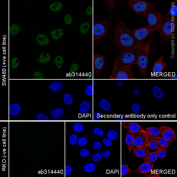 Immunocytochemistry/ Immunofluorescence - Anti-BCL9L antibody [EPR27491-35] - BSA and Azide free (AB314441), expandable thumbnail