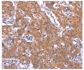 Immunohistochemistry (Formalin/PFA-fixed paraffin-embedded sections) - Anti-BCMA antibody - C-terminal (AB199264)