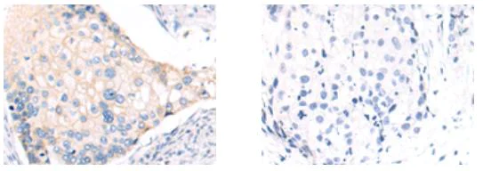 Immunohistochemistry (Formalin/PFA-fixed paraffin-embedded sections) - Anti-BCMA antibody - C-terminal (AB199264)