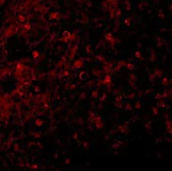 Immunocytochemistry/ Immunofluorescence - Anti-BCMA antibody - C-terminal (AB5972)