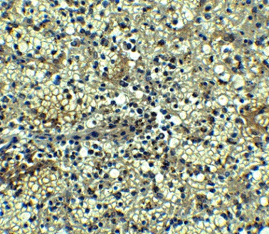 Immunohistochemistry (Formalin/PFA-fixed paraffin-embedded sections) - Anti-BCMA antibody - C-terminal (AB5972)