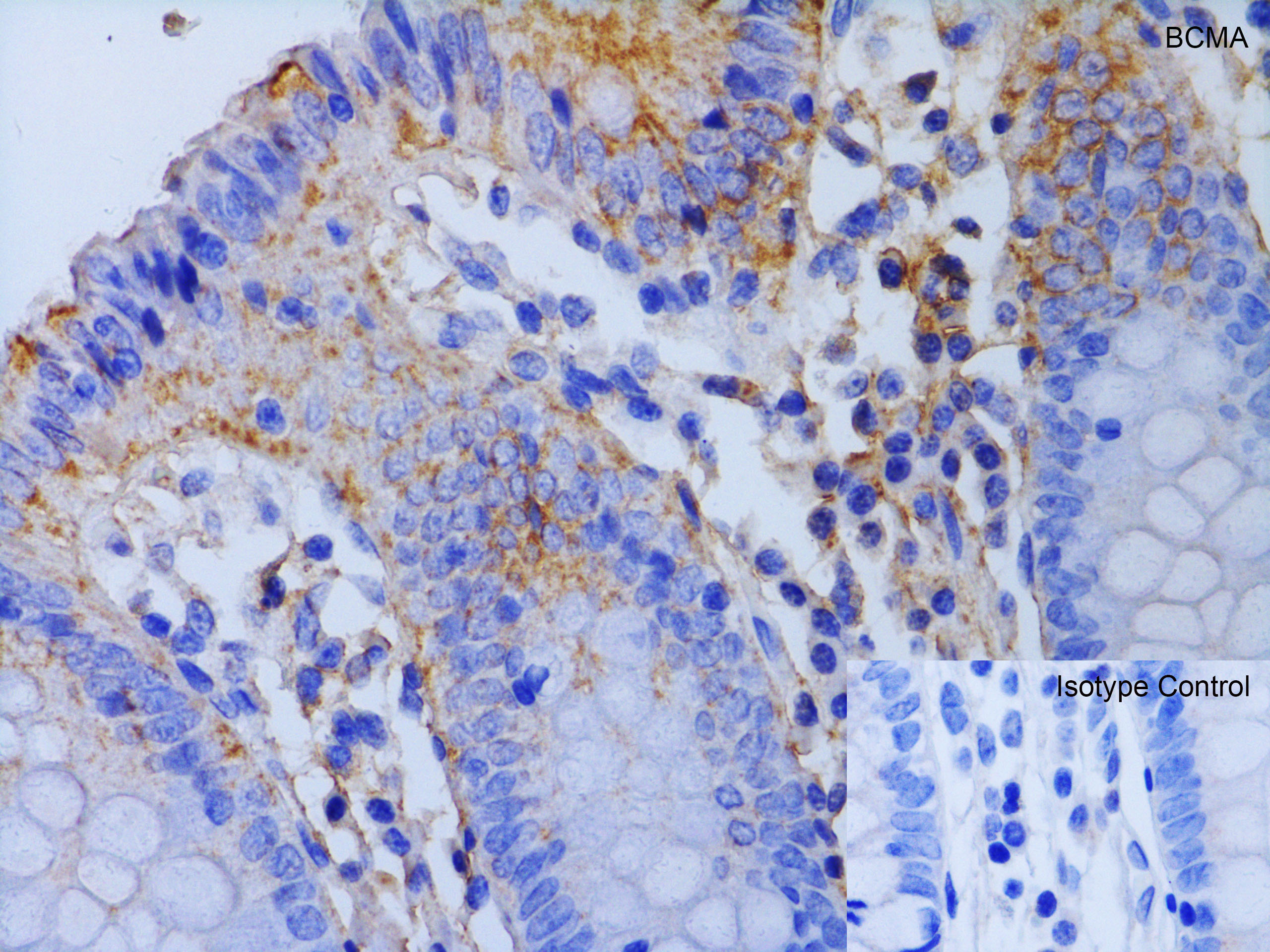 Immunohistochemistry (Formalin/PFA-fixed paraffin-embedded sections) - Anti-BCMA antibody - C-terminal (AB5972)