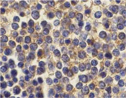 Immunohistochemistry (Formalin/PFA-fixed paraffin-embedded sections) - Anti-BCMA antibody - C-terminal (AB5972)