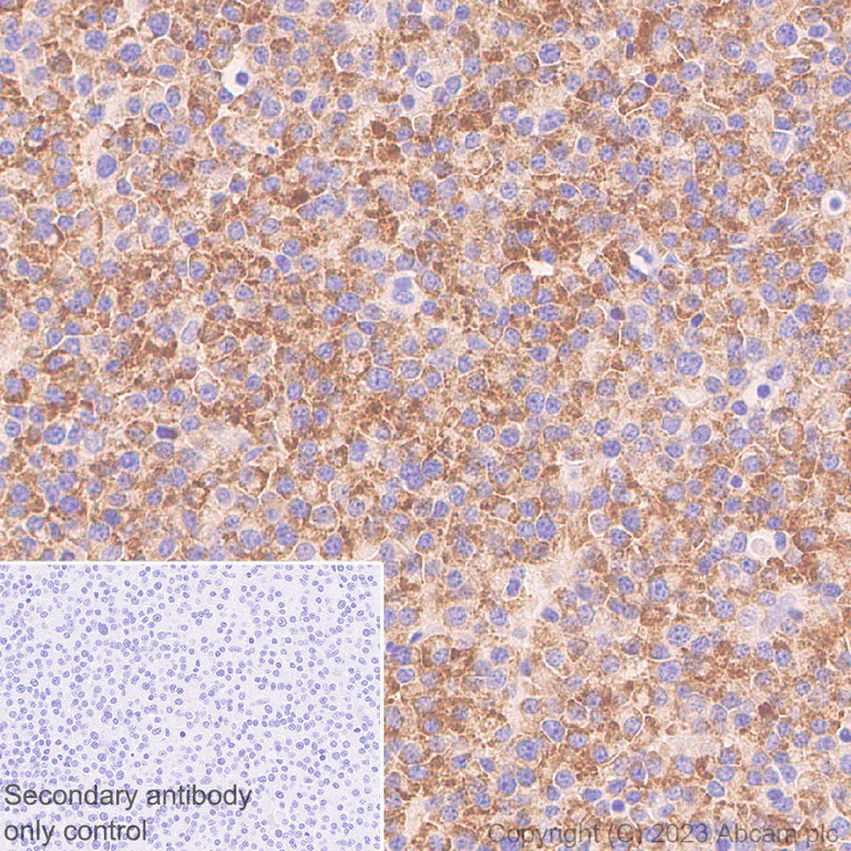Immunohistochemistry (Formalin/PFA-fixed paraffin-embedded sections) - Anti-BCMA antibody [EPR28583-5] (AB315340)