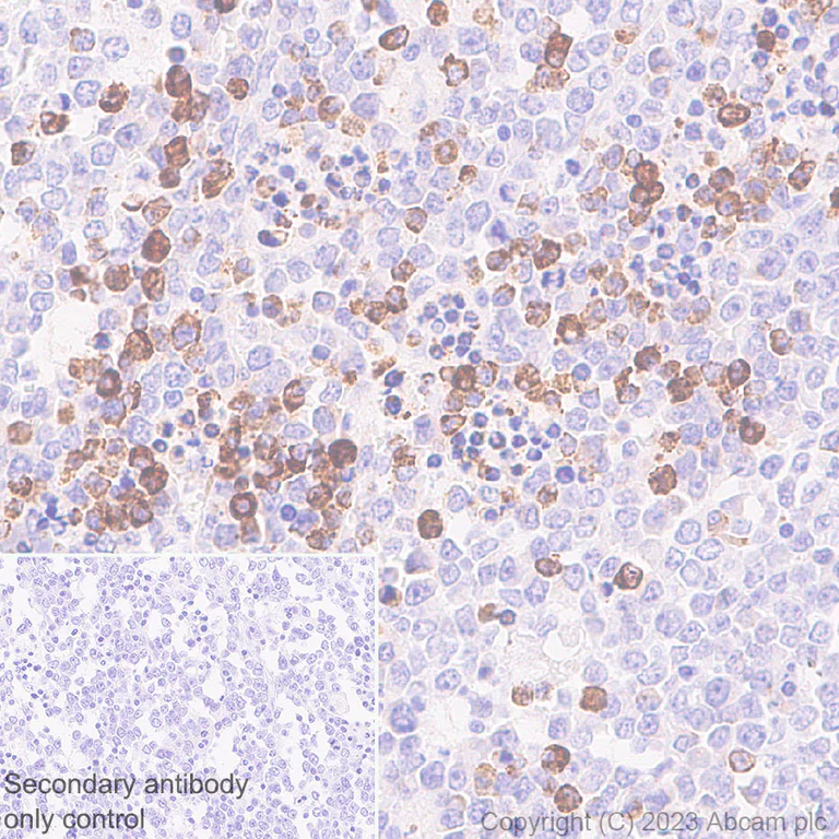 Immunohistochemistry (Formalin/PFA-fixed paraffin-embedded sections) - Anti-BCMA antibody [EPR28583-5] (AB315340)