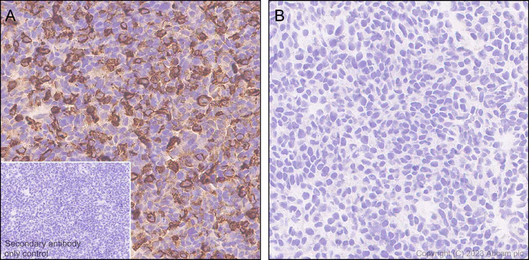 Immunohistochemistry (Formalin/PFA-fixed paraffin-embedded sections) - Anti-BCMA antibody [EPR28583-5] (AB315340)