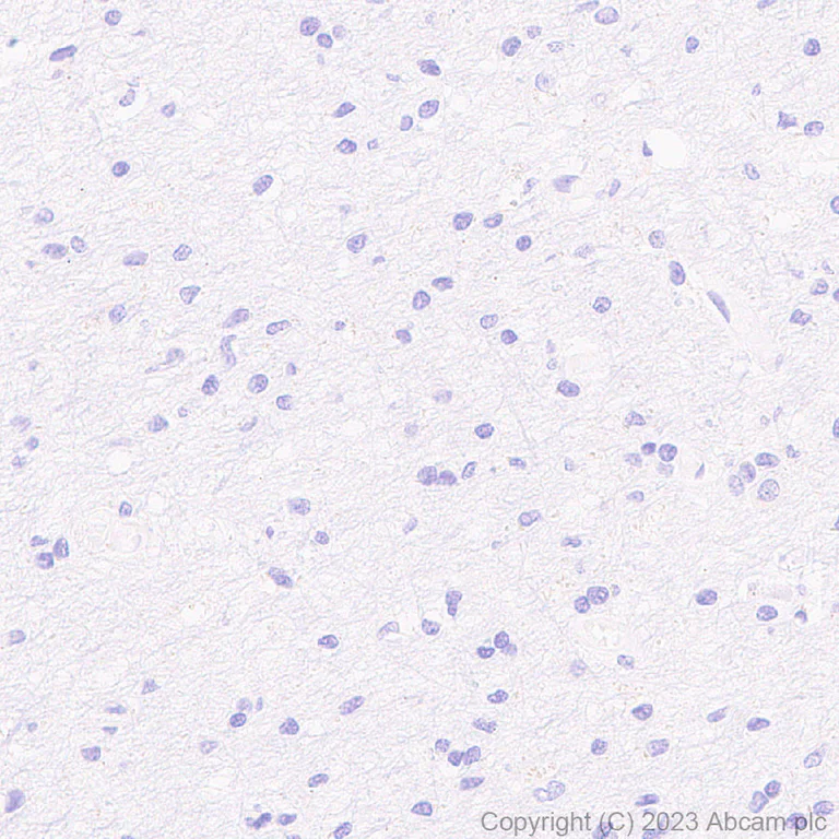 Immunohistochemistry (Formalin/PFA-fixed paraffin-embedded sections) - Anti-BCMA antibody [EPR28583-5] (AB315340)