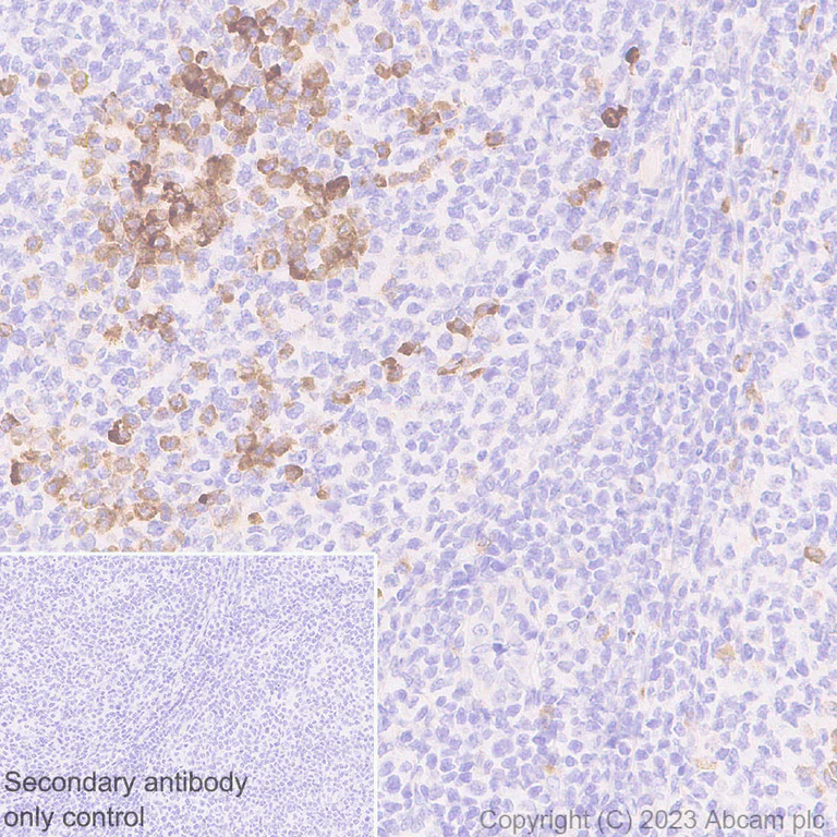 Immunohistochemistry (Formalin/PFA-fixed paraffin-embedded sections) - Anti-BCMA antibody [EPR28583-5] - BSA and Azide free (AB315341)