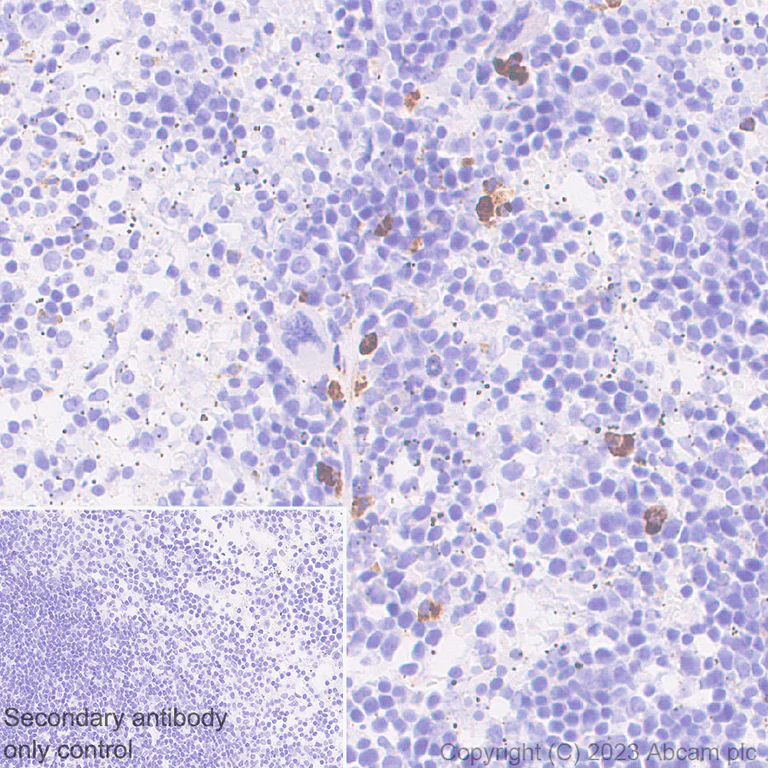 Immunohistochemistry (Formalin/PFA-fixed paraffin-embedded sections) - Anti-BCMA antibody [EPR28583-5] - BSA and Azide free (AB315341)