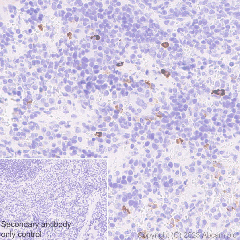 Immunohistochemistry (Formalin/PFA-fixed paraffin-embedded sections) - Anti-BCMA antibody [EPR28583-5] - BSA and Azide free (AB315341)