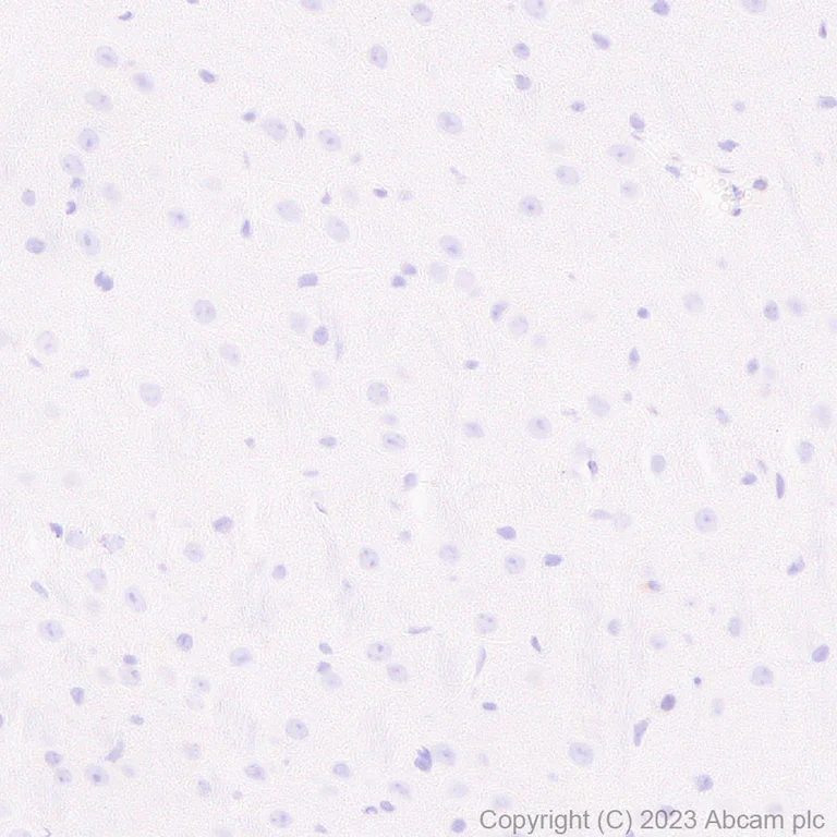 Immunohistochemistry (Formalin/PFA-fixed paraffin-embedded sections) - Anti-BCMA antibody [EPR28583-5] - BSA and Azide free (AB315341)