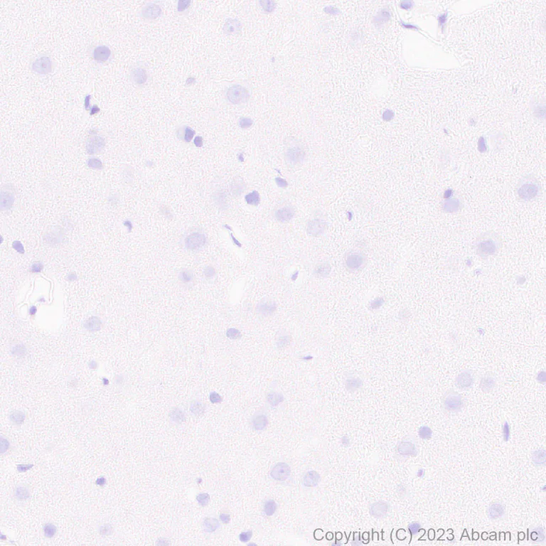 Immunohistochemistry (Formalin/PFA-fixed paraffin-embedded sections) - Anti-BCMA antibody [EPR28583-5] - BSA and Azide free (AB315341)