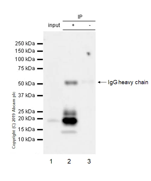 Immunoprecipitation - Anti-BCMA antibody [EPRBOB-R1-F1-24] (AB245940)