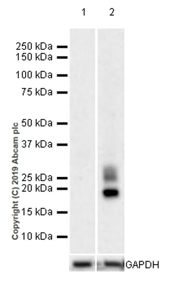 Western blot - Anti-BCMA antibody [EPRBOB-R1-F1-24] (AB245940)