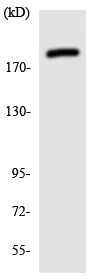 Western blot - Anti-BCOR antibody (AB135975)