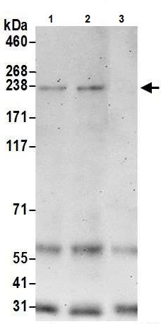 Immunoprecipitation - Anti-BCOR antibody (AB245422)
