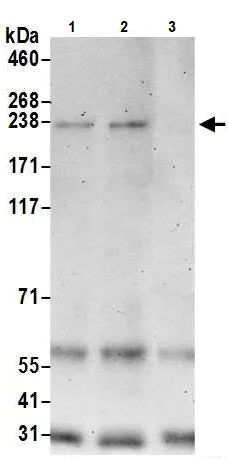 Immunoprecipitation - Anti-BCOR antibody (AB245422)