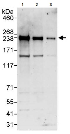 Western blot - Anti-BCOR antibody (AB245423), expandable thumbnail