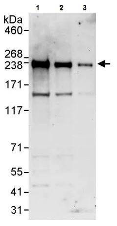 Western blot - Anti-BCOR antibody (AB245423)