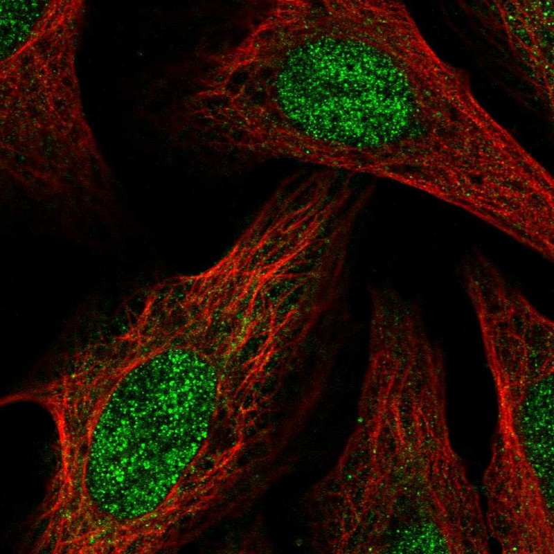 Immunocytochemistry/ Immunofluorescence - Anti-BCOR antibody (AB262908)