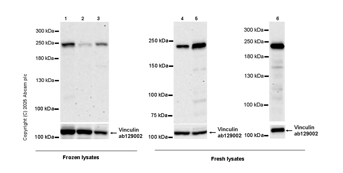 Western blot - Anti-BCOR antibody [EPR29210-51] (AB323412), expandable thumbnail