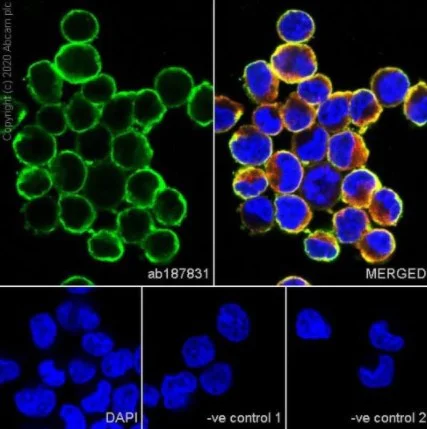 Immunocytochemistry/ Immunofluorescence - Anti-Bcr-abl antibody [7C6] (AB187831)