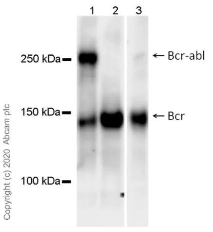 Western blot - Anti-Bcr-abl antibody [7C6] (AB187831)