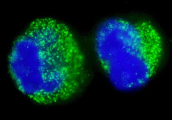 Immunocytochemistry/ Immunofluorescence - Anti-Bcr antibody (AB245511)