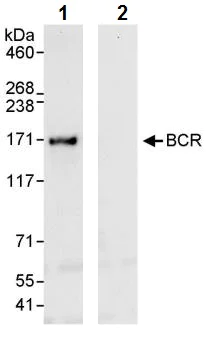 Immunoprecipitation - Anti-Bcr antibody (AB245511)