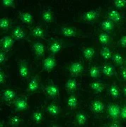Immunocytochemistry/ Immunofluorescence - Anti-Bcr antibody [EP535Y] (AB40779)
