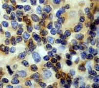 Immunohistochemistry (Formalin/PFA-fixed paraffin-embedded sections) - Anti-Bcr antibody [EP535Y] (AB40779)