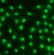 Immunocytochemistry/ Immunofluorescence - Anti-Bcr antibody [EP535Y] - BSA and Azide free (AB247287)