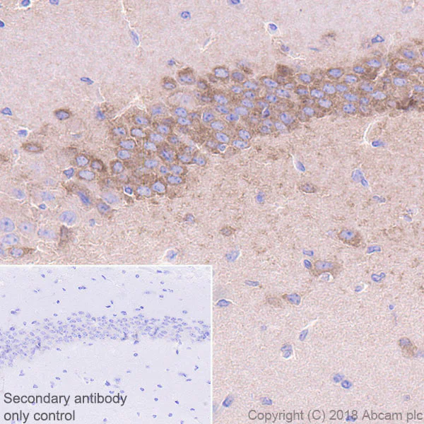 Immunohistochemistry (Formalin/PFA-fixed paraffin-embedded sections) - Anti-Bcr antibody [EPR22062] (AB222406)