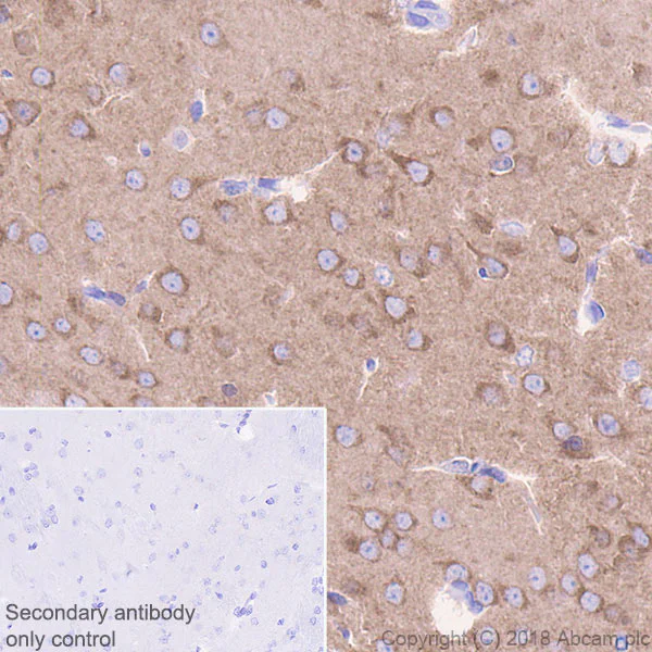 Immunohistochemistry (Formalin/PFA-fixed paraffin-embedded sections) - Anti-Bcr antibody [EPR22062] (AB222406)