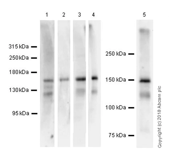 Western blot - Anti-Bcr antibody [EPR22062] (AB222406)