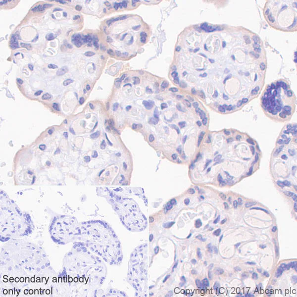 Immunohistochemistry (Formalin/PFA-fixed paraffin-embedded sections) - Anti-BCRP/ABCG2 antibody [EPR21122] (AB229193)