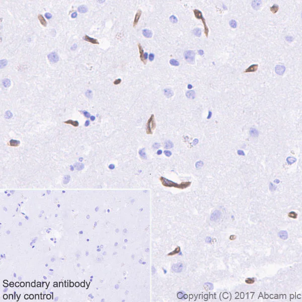 Immunohistochemistry (Formalin/PFA-fixed paraffin-embedded sections) - Anti-BCRP/ABCG2 antibody [EPR21122] - BSA and Azide free (AB230160)