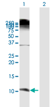 Western blot - Anti-BD-3 antibody (AB172703)