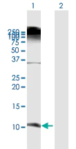 Western blot - Anti-BD-3 antibody (AB172703)