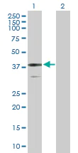 Western blot - Anti-BDH1 antibody (AB103500)